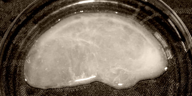 Sperma Dickflüssig